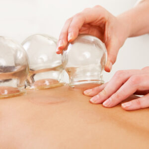 Cupping (Hijama) Therapy – Natural Healing Through Ancient Wisdom