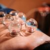 Cupping (Hijama) Therapy – Natural Healing Through Ancient Wisdom