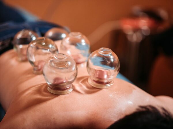 Cupping (Hijama) Therapy – Natural Healing Through Ancient Wisdom