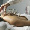 Cupping (Hijama) Therapy – Natural Healing Through Ancient Wisdom