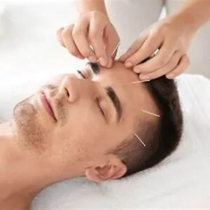 Acupuncture Therapy