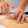 Combined Session (Chiro + Acupuncture)