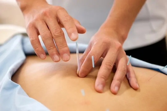Combined Session (Chiro + Acupuncture)