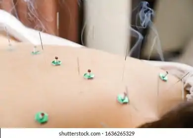 Combined Session (Chiro + Acupuncture)